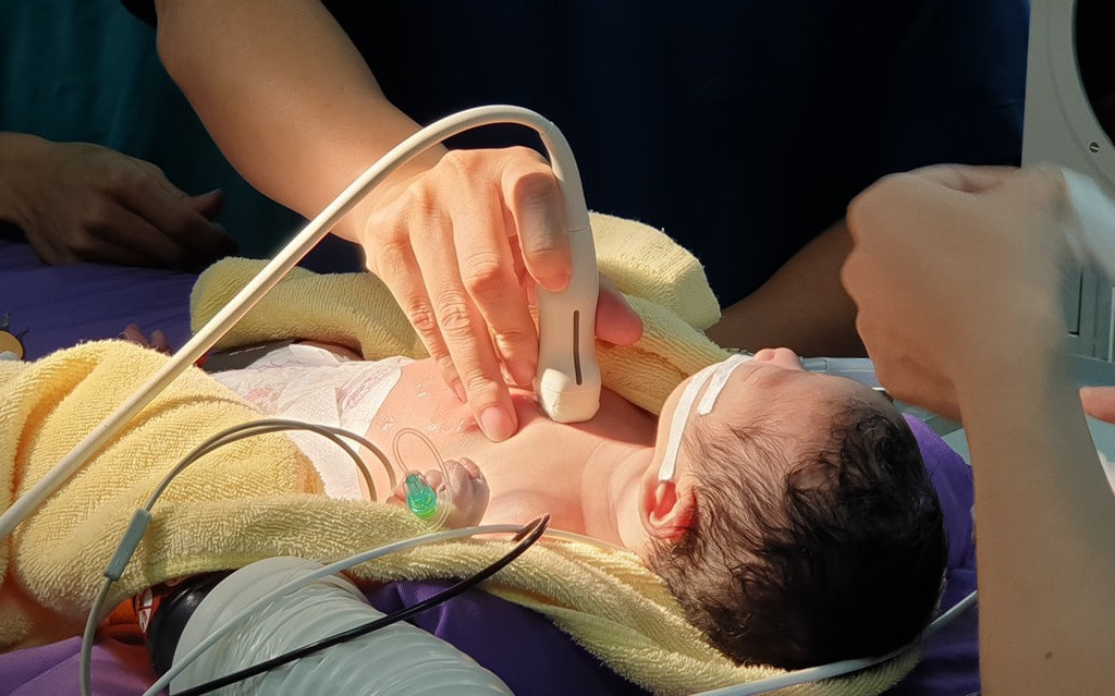 Bàn chân với móng tay trẻ sơ sinh bị thâm, có thể là dấu hiệu bệnh lý tiềm ẩn