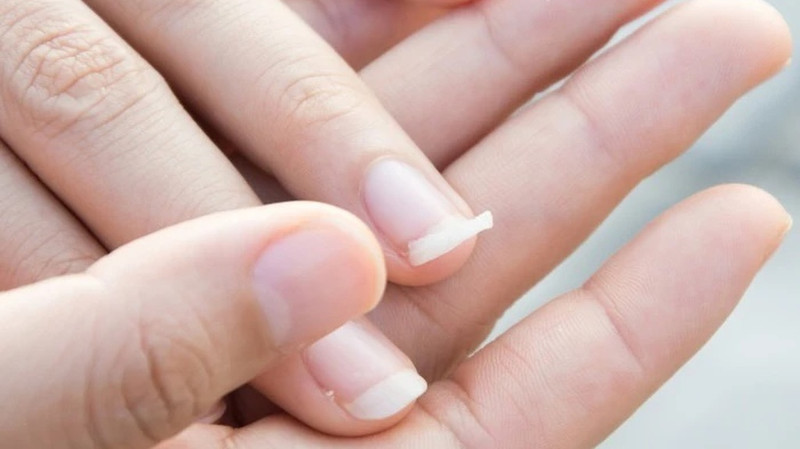 Bàn tay đang cắt móng tay, minh họa việc cắt móng không đúng cách là nguyên nhân gây móng mọc ngược