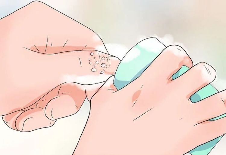 Chín Khoé Móng Tay: Hiểu Rõ Nguyên Nhân và Điều Trị Hiệu Quả Bàn tay đang được vệ sinh sạch sẽ, minh họa cách phòng ngừa chín khoé móng tay hiệu quả