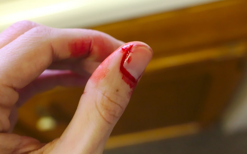 Bàn tay được băng bó và sát trùng vết thương móng tay bao lâu mọc lại