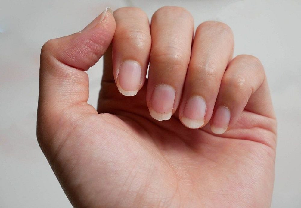 Bàn tay với các móng khỏe mạnh, hồng hào, đối lập với tình trạng móng tay trong suốt yếu ớt