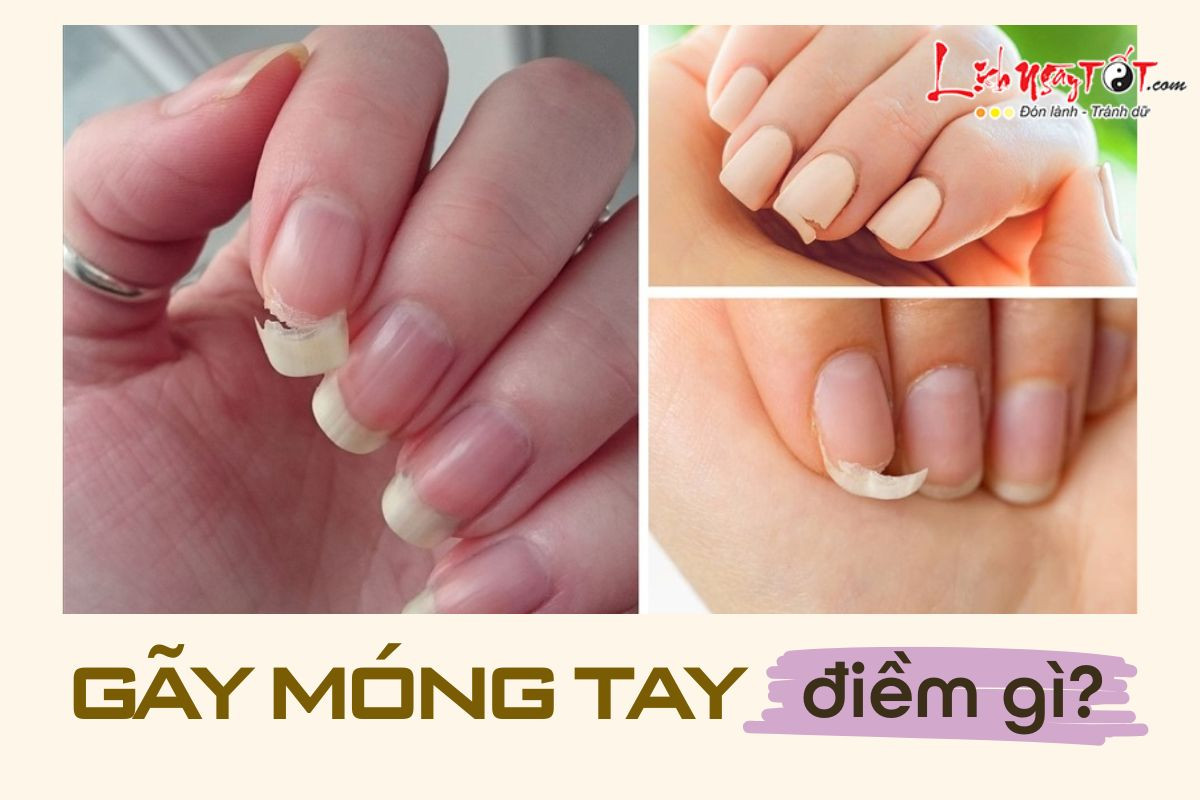 Bàn tay với móng tay bị gãy thể hiện điềm báo trong giấc mơ