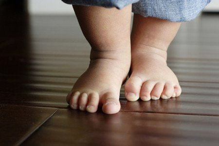 Bé bị sưng khóe móng chân khiến trẻ nhăn nhó khi đi