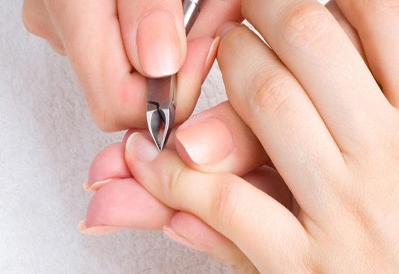 Cắt móng tay quá sâu có thể dẫn đến chín mé và nguy cơ móng bị tụt