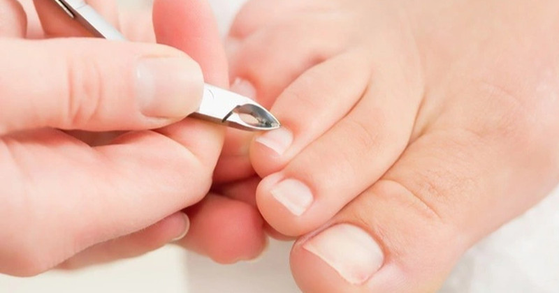 Cấu trúc móng chân bình thường và các bộ phận