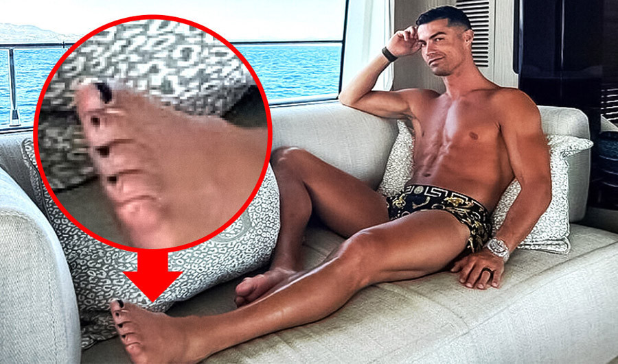 Cristiano Ronaldo với móng chân sơn đen chuyên biệt trong buổi tập phục hồi