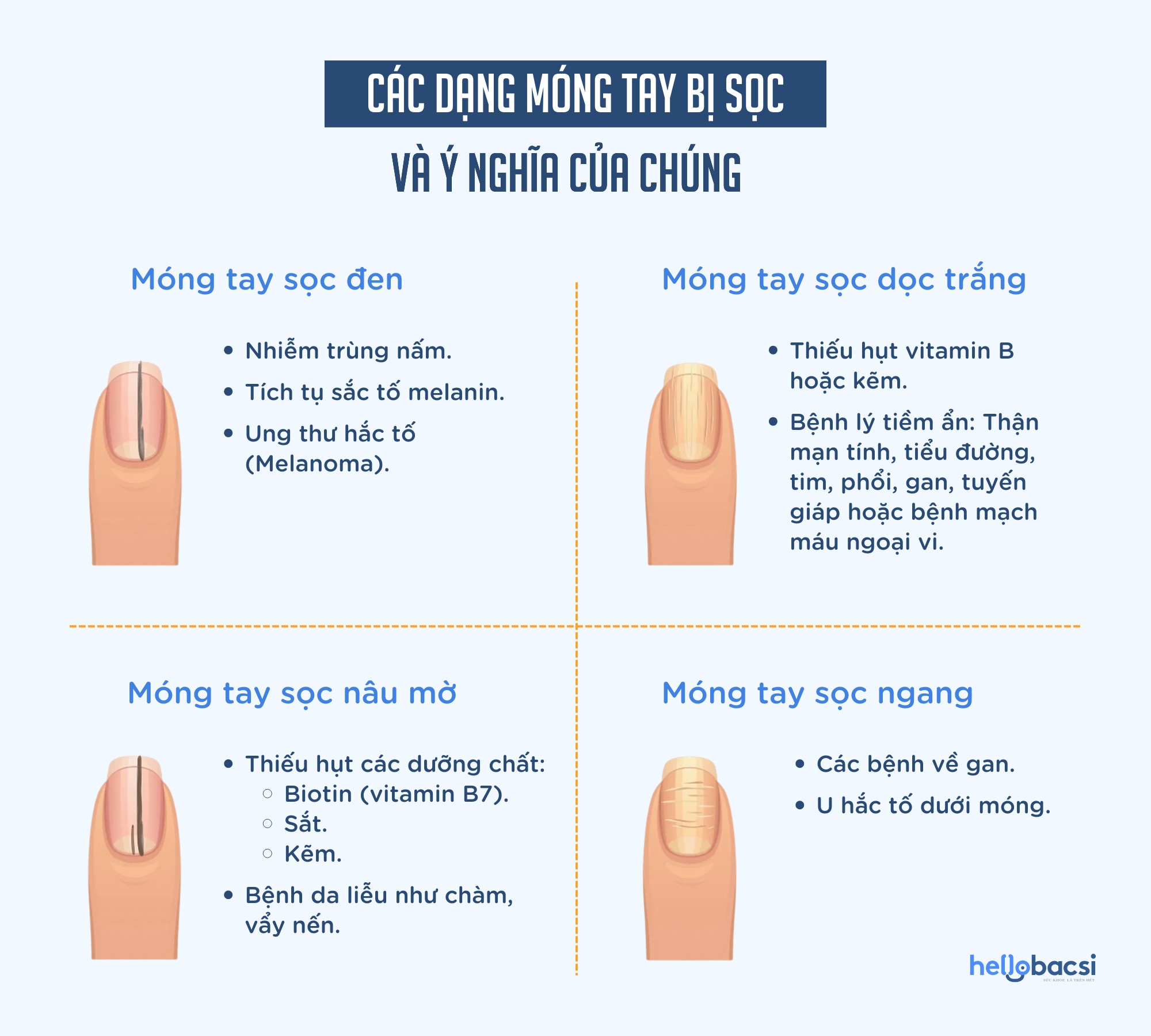 Hình ảnh minh họa các dạng móng tay có đường sọc đen và sọc khác nhau