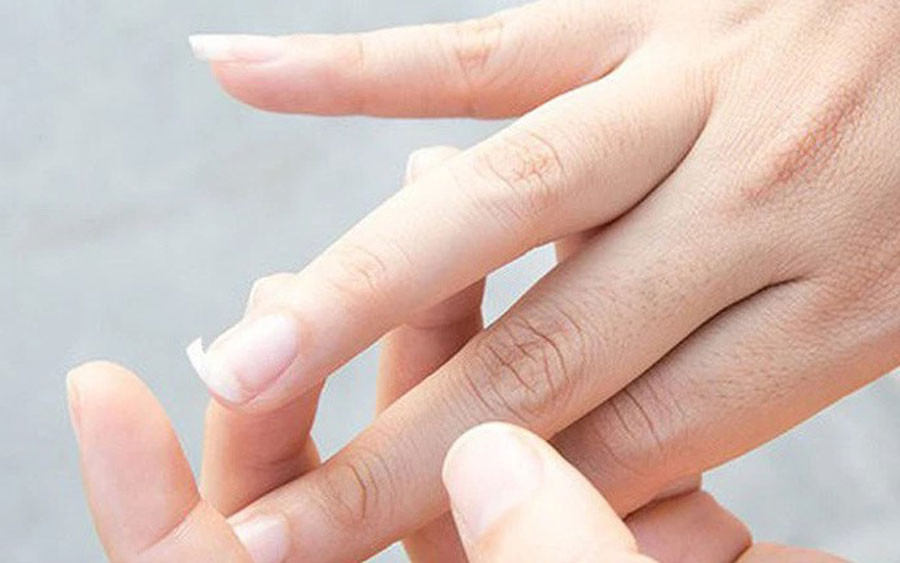 Hình ảnh móng tay yếu, dễ gãy minh họa cho nguyên nhân móng tay hư tổn, cần được dưỡng móng tay dài và cứng.