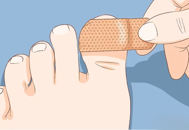 Hình ảnh một người đang chườm đá lên ngón chân cái bị thương