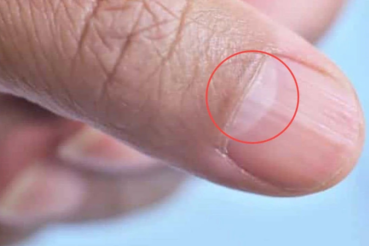 Hình ảnh tổng quan về hình bán nguyệt trên móng tay, giải thích cấu trúc móng khỏe mạnh