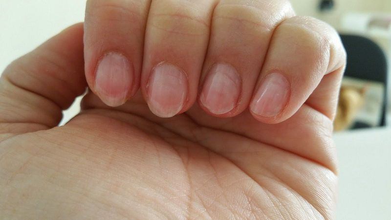 Hóa chất tẩy rửa gây hại cho móng tay và làm móng dễ gãy