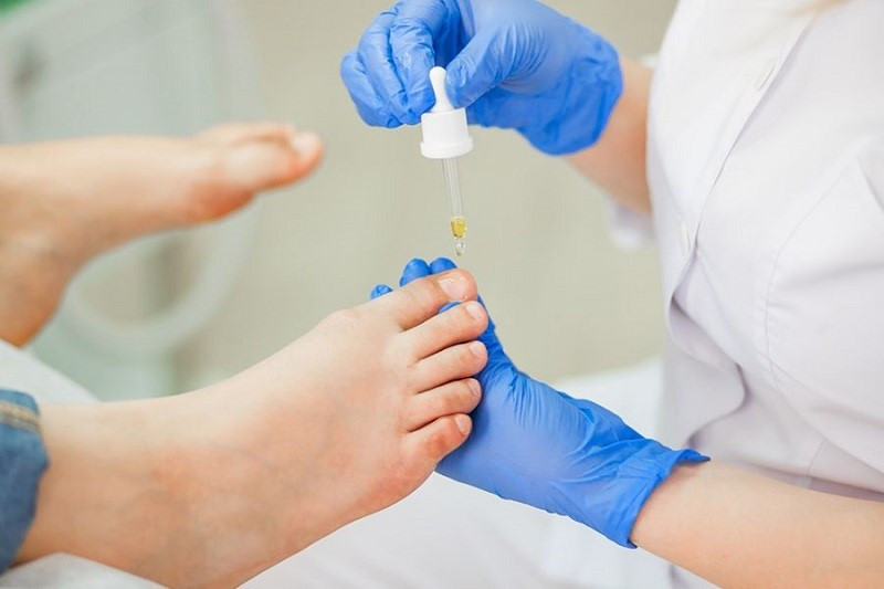 Khám bác sĩ khi cách chữa viêm kẽ móng chân tại nhà không hiệu quả