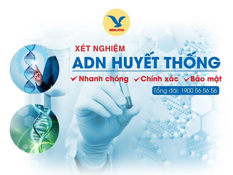 Móng Tay Có Xét Nghiệm ADN Được Không? Giải Đáp Chi Tiết Lựa chọn địa chỉ uy tín để giải đáp móng tay có xét nghiệm ADN được không