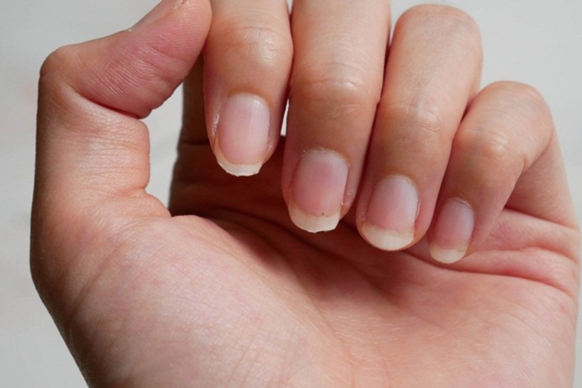 Mối liên hệ giữa hình bán nguyệt trên từng ngón tay và tình trạng sức khỏe tổng thể