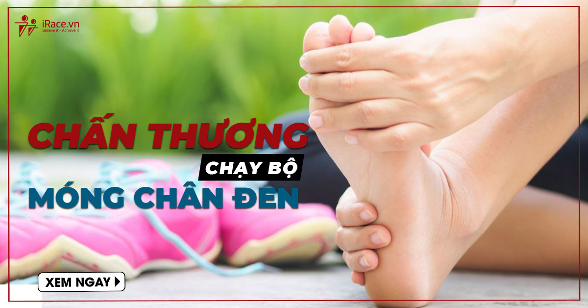 Móng chân bị đen do chấn thương khi chạy bộ