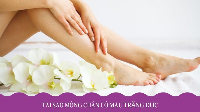 Móng chân màu trắng đục có thể do nấm hoặc thiếu chất