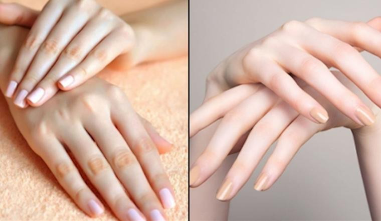 Móng Tay Bị Mềm: Nguyên Nhân Và Giải Pháp Chắc Khỏe