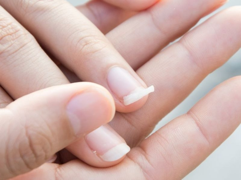Móng tay dễ nứt và gãy trên cơ thể người có thể trạng yếu