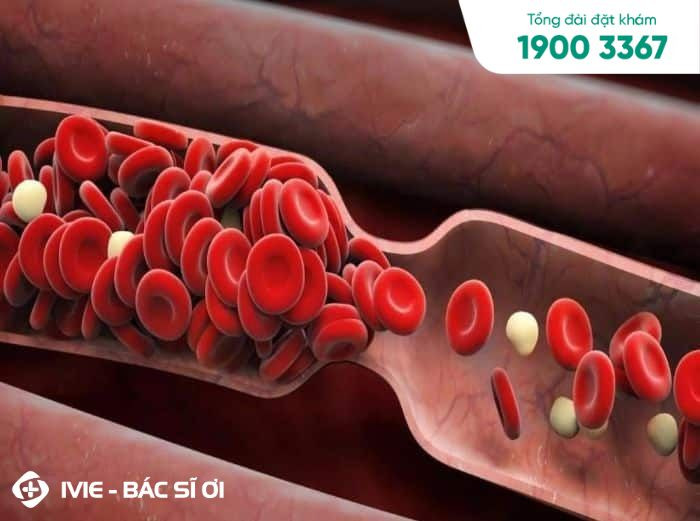Móng tay trẻ em bị bong tróc, cảnh báo nguy cơ bệnh mạch máu ngoại vi