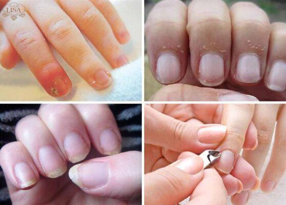 Quá trình cắt tỉa và làm sạch móng tay trước khi bắt đầu làm móng tại nhà