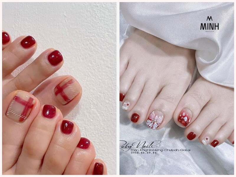 Sơn móng chân màu đỏ cherry tươi tắn và trẻ trung