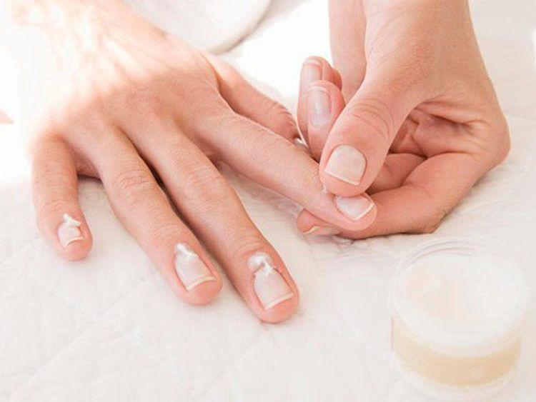 Thuốc điều trị nhiễm nấm cho móng tay bị vảy nến