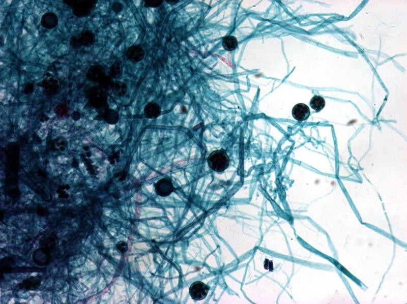 Tiếp xúc gần có thể lây truyền tác nhân gây móng tay bị nước ăn