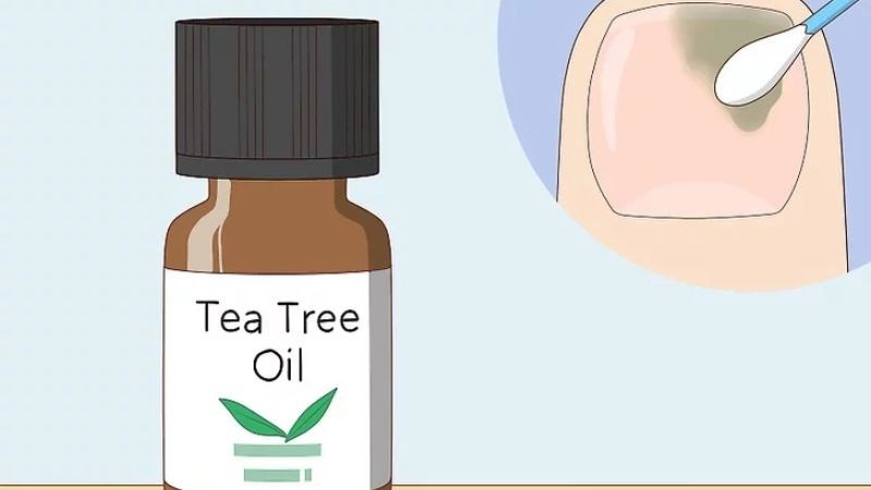 Tinh dầu tràm trà giúp dưỡng móng chân khỏe mạnh và phòng ngừa nấm
