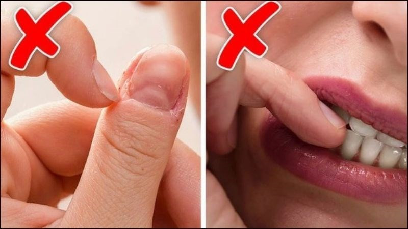 Tránh cắn móng chân là một cách hiệu quả để ngăn ngừa bong tróc