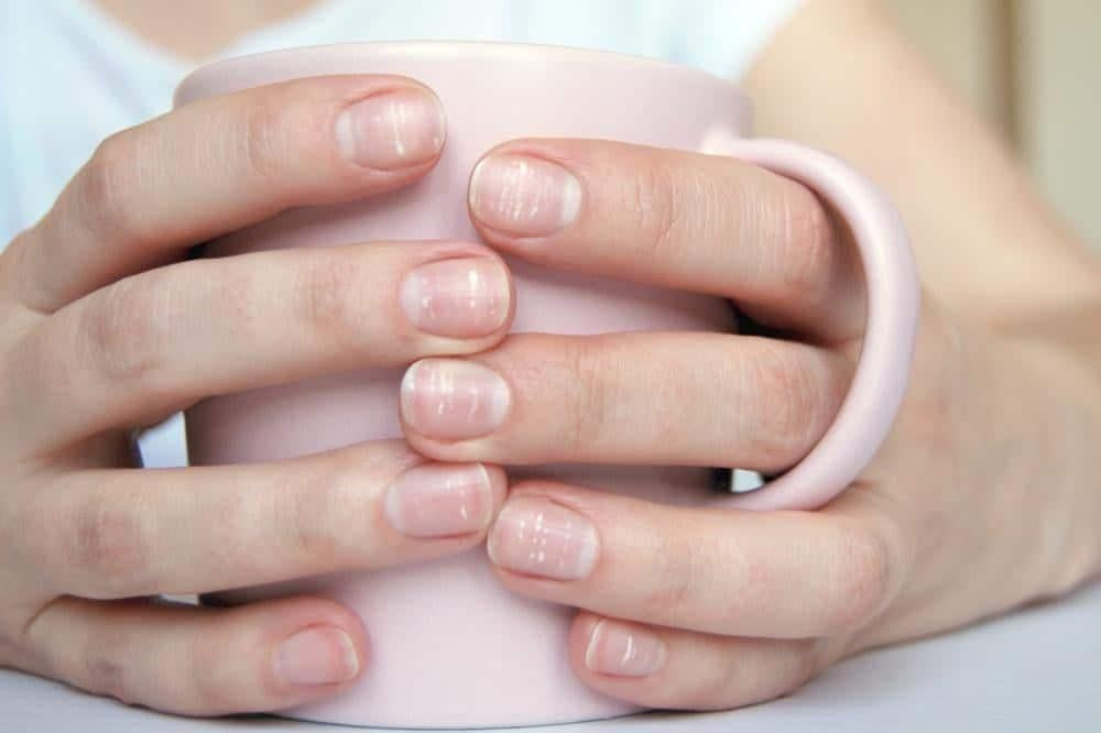 Vấn đề về móng tay: Móng tay có đốm trắng