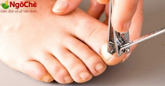 Ý nghĩa giấc mơ về móng chân
